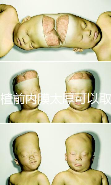 移植前內膜太厚可以取卵早知道，疼痛因人而異