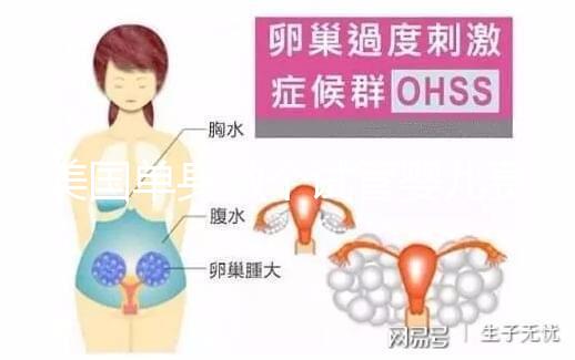 美國單身做個試管嬰兒費用大概要多少？