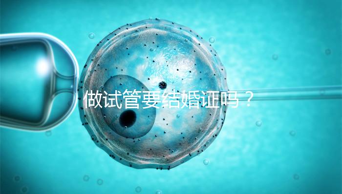 做試管要結婚證嗎？