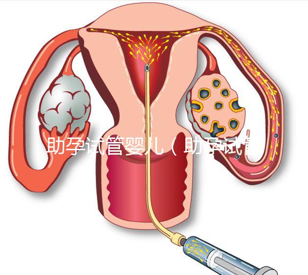 助孕試管嬰兒（助孕試管嬰兒保險）