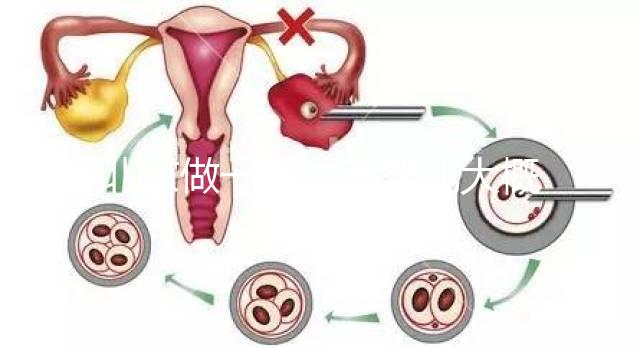 北京做一次試管嬰兒大概花多少錢？2025年價格及明細清單一覽！