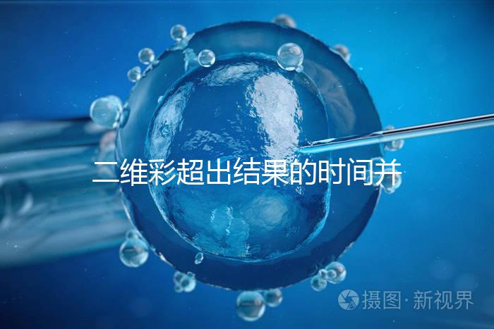 二維彩超出結(jié)果的時間并不長，從檢查流程便可看出