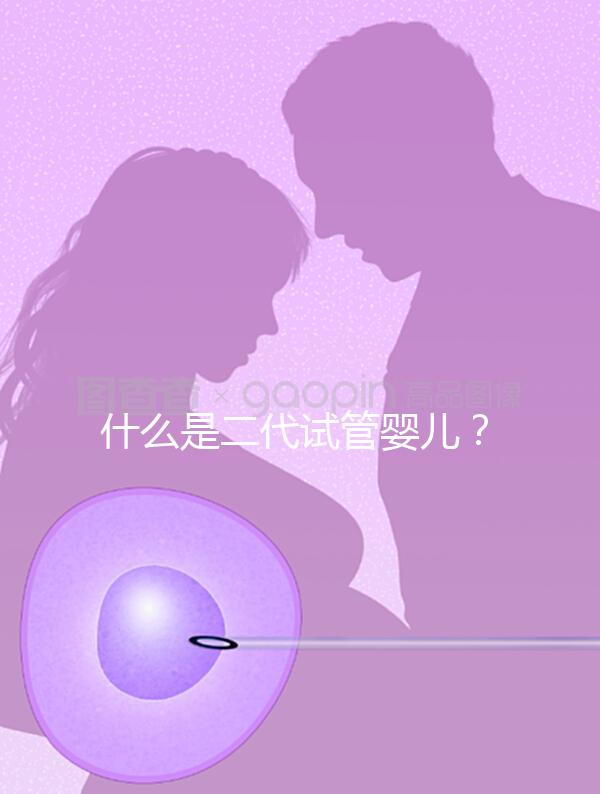 什么是二代試管嬰兒？