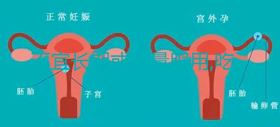 不宜長期或過量服用,吃DHEA要注意這3點