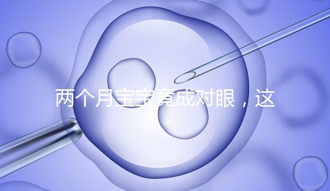 兩個(gè)月寶寶竟成對眼，這5大形成原因家長必知