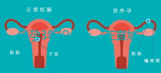 備孕3年沒懷上，在宣城可以做試管嬰兒嗎？