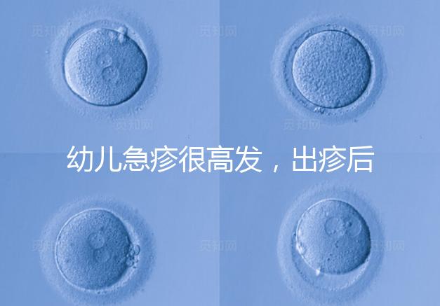 幼兒急疹很高發，出疹后的護理方法及注意事項提前知曉！