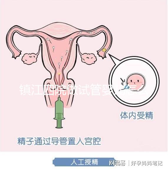 鎮江四院做試管嬰兒怎么樣？具體成功率費用介紹