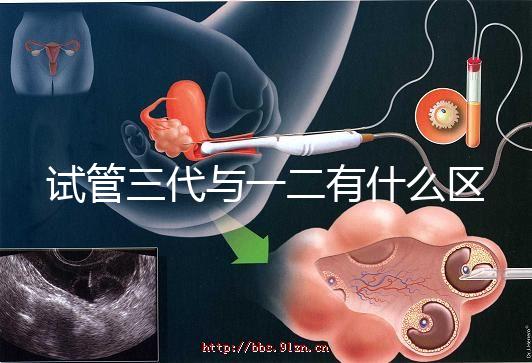 試管三代與一二有什么區別的？？