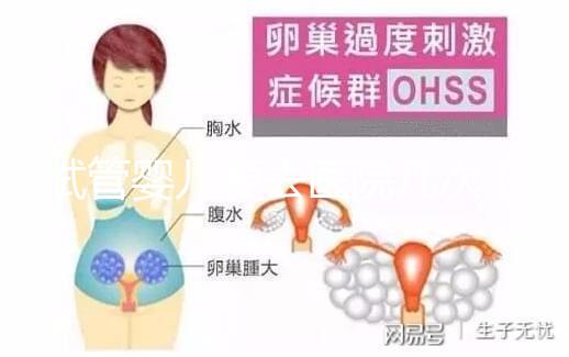 試管嬰兒要去醫院幾次（試管嬰兒要去醫院幾次？）