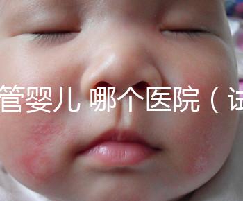 試管嬰兒 哪個醫(yī)院（試管嬰兒哪個醫(yī)院做的最好）