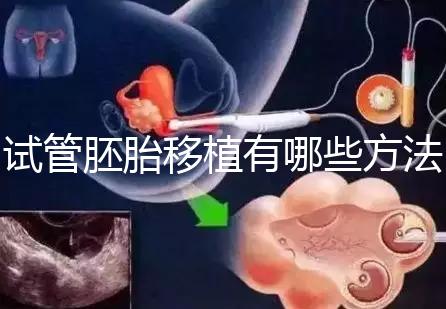 試管胚胎移植有哪些方法？