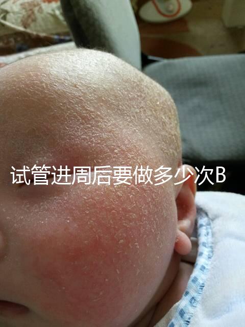 試管進周后要做多少次B超？需要檢查什么？進來看看