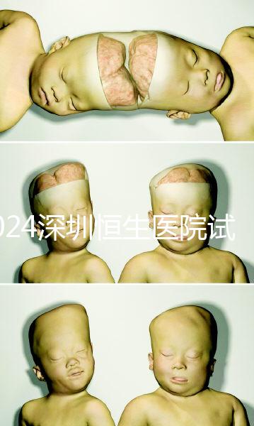 2024深圳恒生醫(yī)院試管嬰兒費用,造娃價格清單表一覽